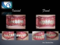 /album/casos-clinicos1/m-l-lamego-jpg2/